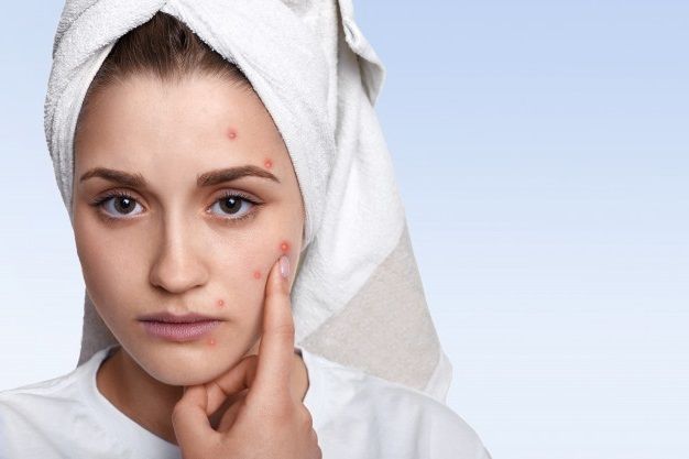 Treat Acne with Red Light Therapy